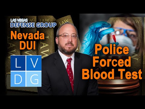 Can Nevada police force me to take a blood test after a Nevada DUI?