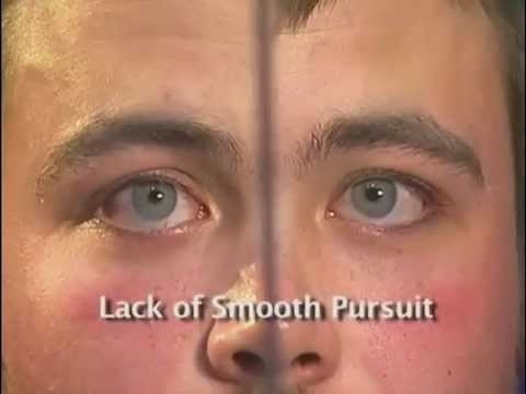 Measuring the Strength of a Person's Gaze