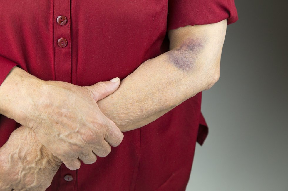 A Palm Springs, California Elder Abuse Conviction Comes with Stiff Penalties