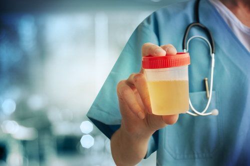 lab tech holding a container of urine specimen 