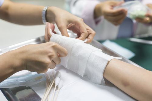 Mano de la víctima de lesión por quemadura siendo envuelta quirúrgicamente - las víctimas de lesiones por quemaduras a menudo pueden presentar una demanda en California
