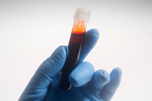 técnico de laboratorio sosteniendo una muestra de sangre