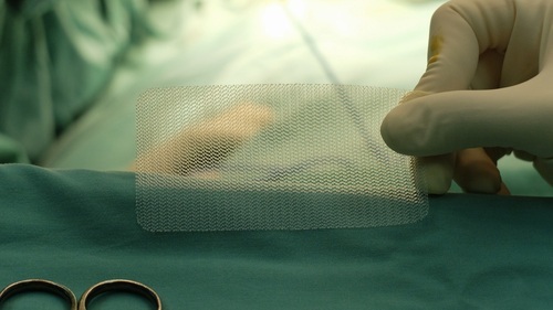 Hernia mesh being prepared for implant during surgery
