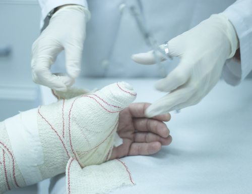 el médico coloca un yeso en el brazo y la mano de la paciente