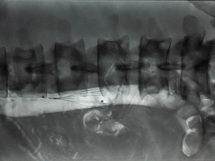 x-ray