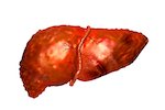 liver