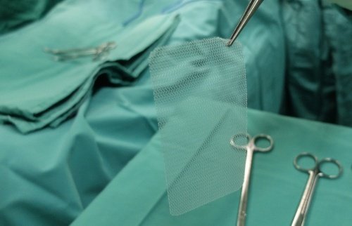 Surgical mesh on operating table - the brand of mesh used is a key thing plaintiffs should know before bringing their hernia mesh lawsuit