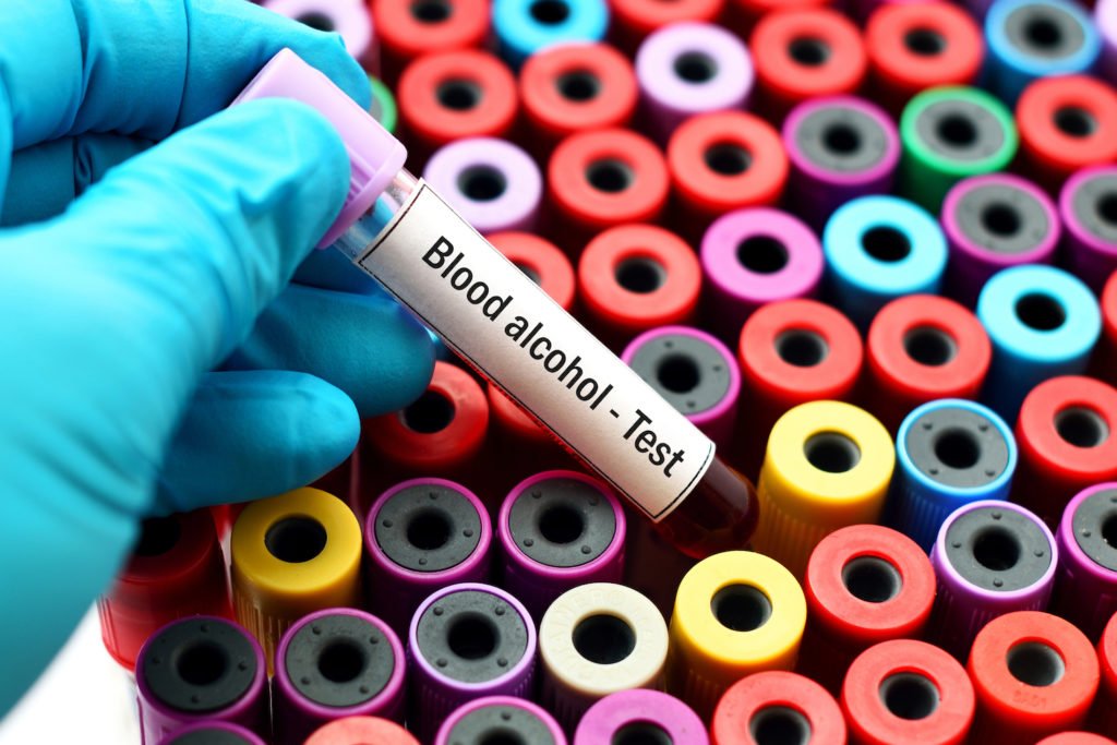 Test tubes of blood - the results of the DUI blood test can sometimes be excluded from evidence by way of a suppression motion