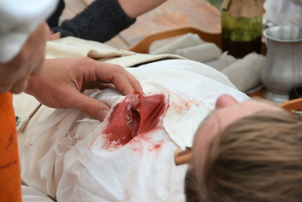Paciente con herida de bala en la mesa como ejemplo de agresión con lesiones graves en Nevada