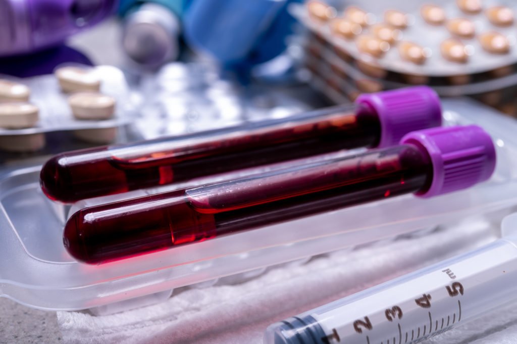 Marijuana DUI Test Is There One?