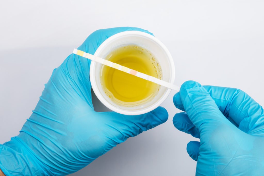 Manos con guantes manipulando muestra de orina y tira de prueba