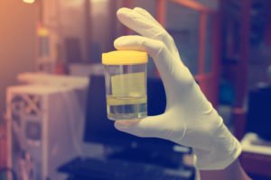 Gloved hand holding urine sample