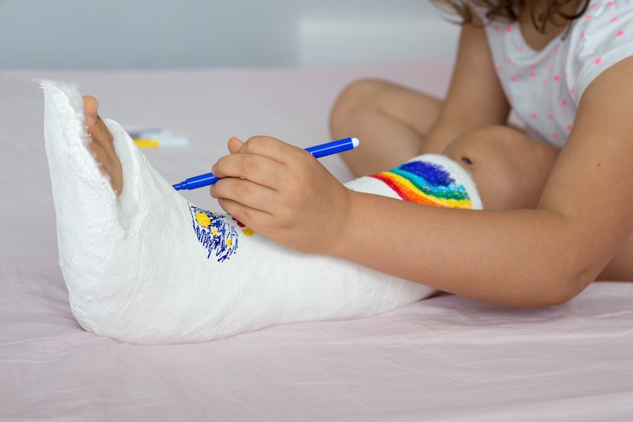 Young injured child drawing with marker on her leg cast as she lies on a bed