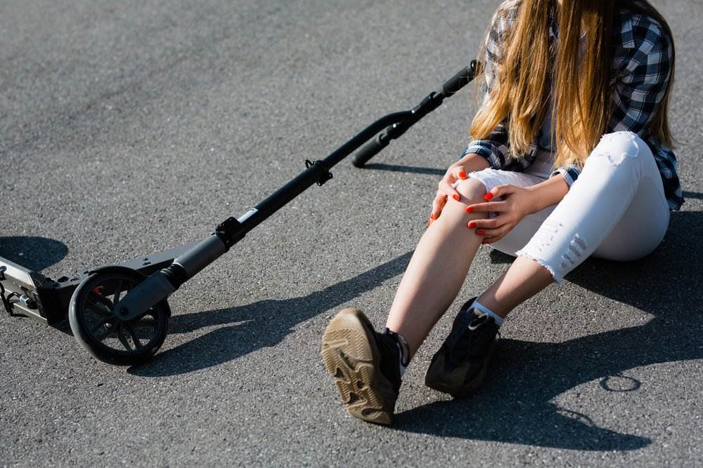 A young woman injured on the ground after a scooter accident - our California Scooter Accident Lawyers help victims to bring lawsuits