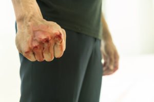 Hombre violento y agresivo en una pelea, con el puño ensangrentado.
