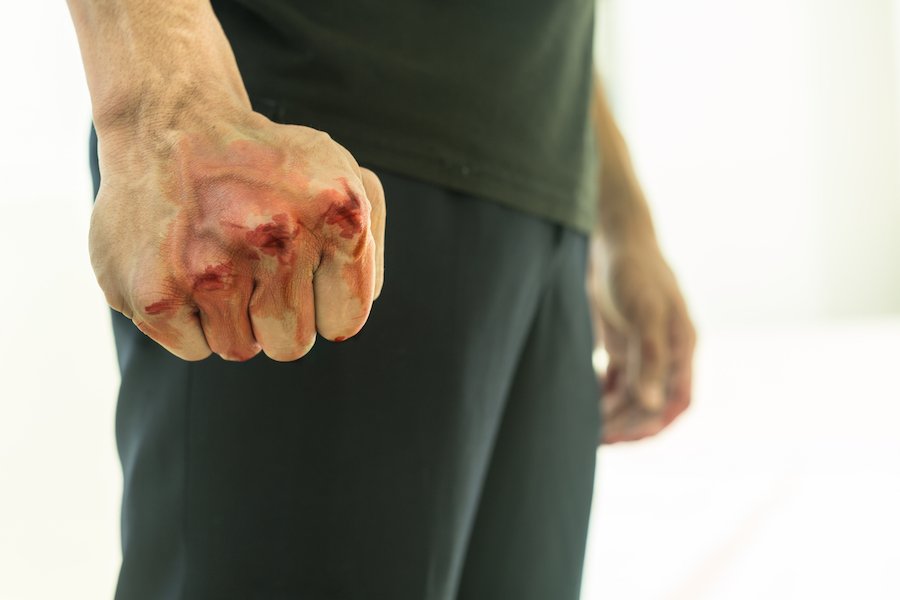 Man's bloody fist following a punch, against a white background