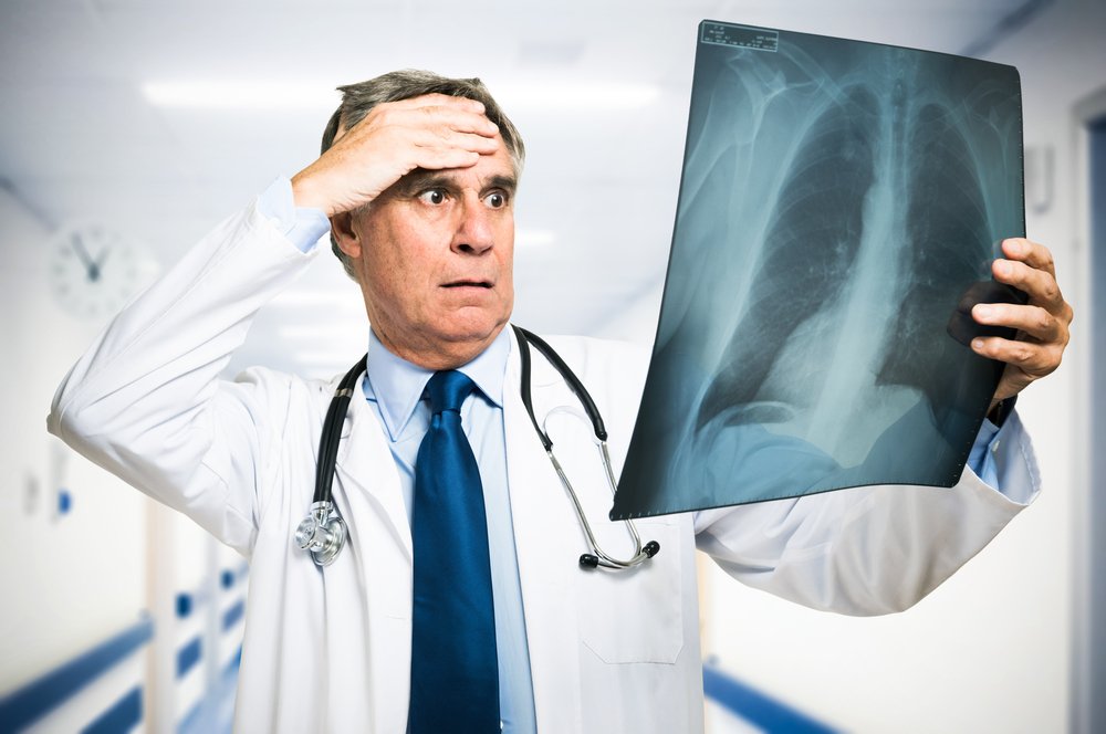 A worried doctor examining an Xray in disbelief.