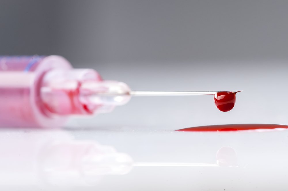 Una aguja goteando sangre, posiblemente infectada con el VIH.