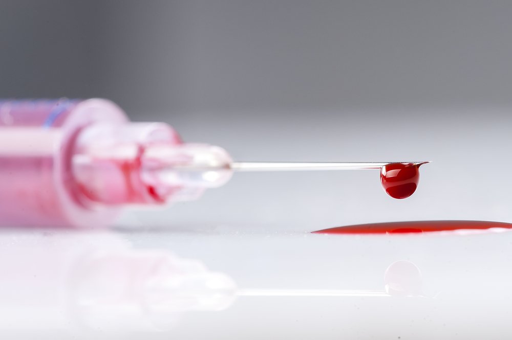 Una aguja goteando sangre, posiblemente infectada con VIH.