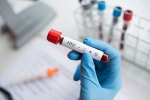 Lab tech hand holding a blood vial that says HIV