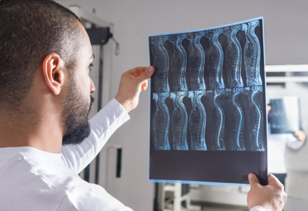 Un radiólogo revisando una radiografía de una médula espinal potencialmente dañada..