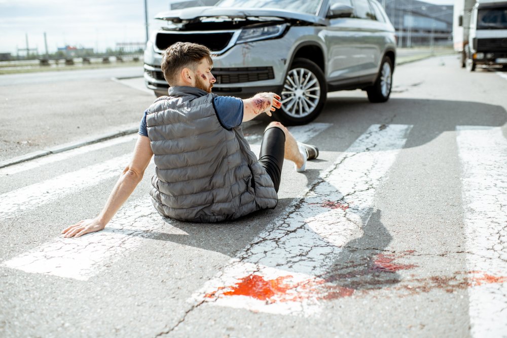 A pedestrian badly injured after being hit by a car.