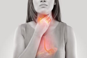 Woman suffering from GERD with an outline of her esophagus inflamed
