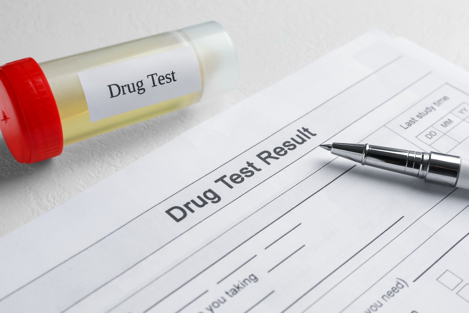 Frasco que contiene un resultado de prueba de orina junto a un papel titulado "resultado de prueba de drogas"
