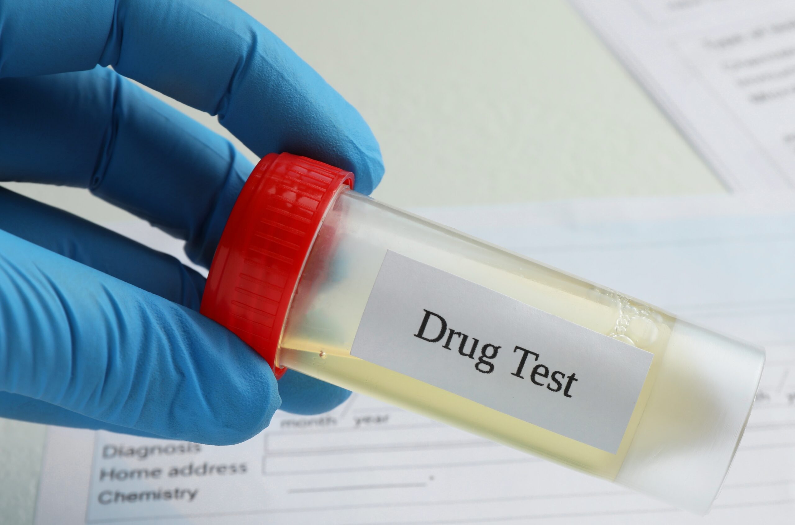 Mano con guantes sosteniendo un frasco de orina etiquetado como "Prueba de drogas"