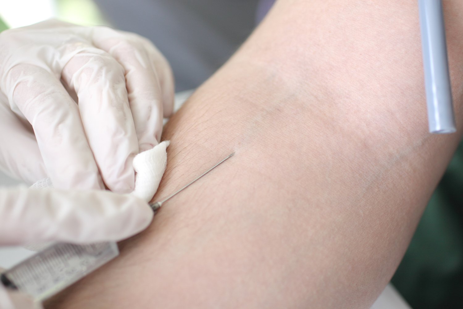 Needle going into an arm during a blood draw after a DUI arrest