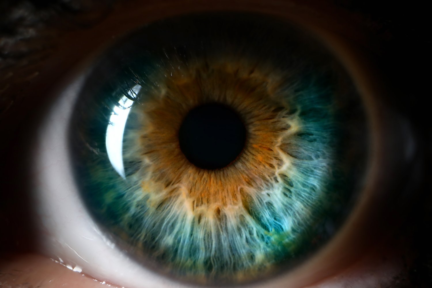 Close-up of eyeball during an eye exam in a doctor's office