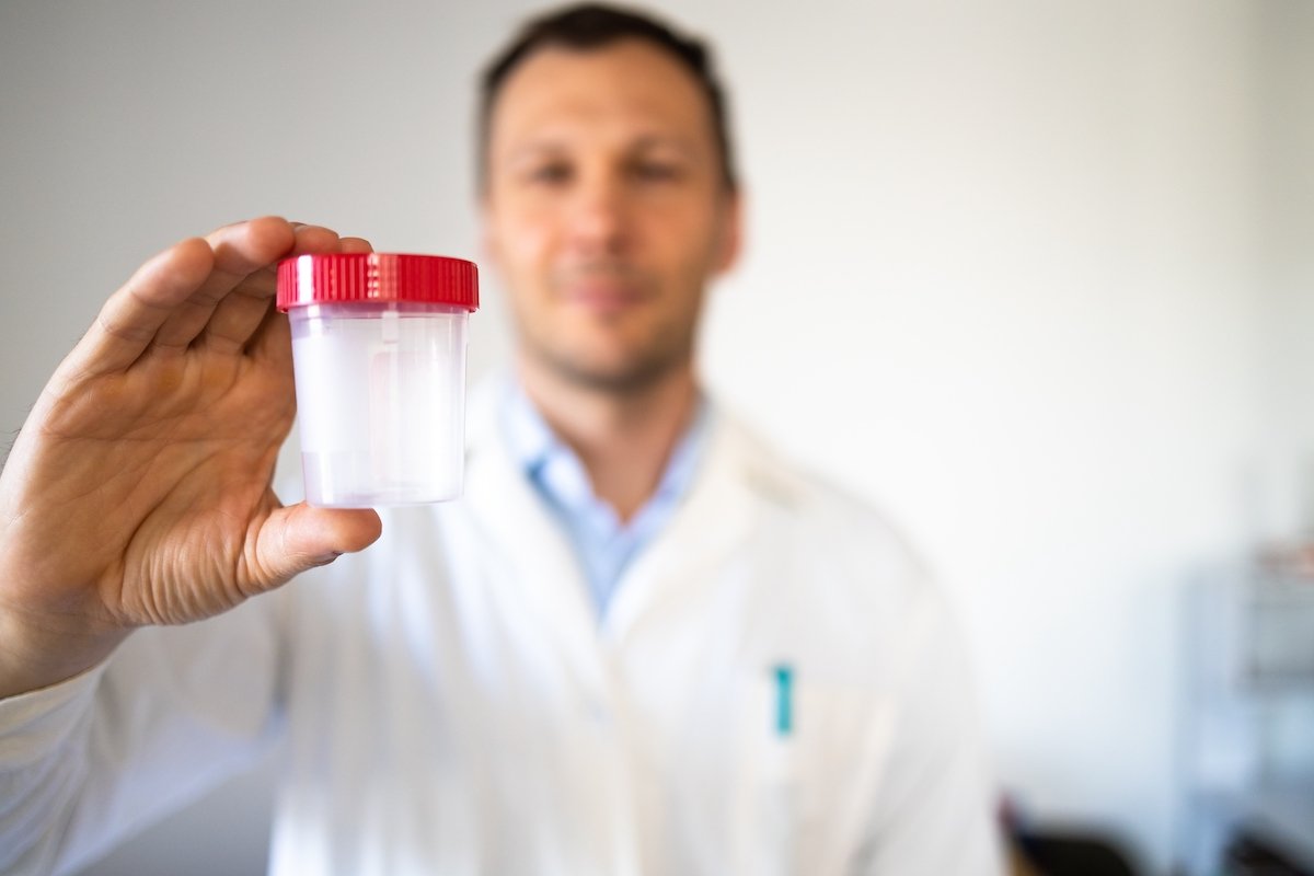 Doctor holding up a urine cup for a drug test